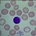 Glóbulos rojos normales (redondos)
